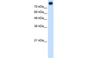 Western Blotting (WB) image for anti-P-Cadherin (CDH3) antibody (ABIN2462833) (P-Cadherin 抗体)