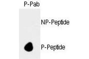 Dot blot analysis of anti-hRb- Phospho-specific Pab (ABIN389645 and ABIN2839637) on nitrocellulose membrane. (Retinoblastoma 1 抗体  (pSer788))