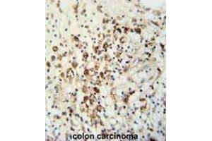 Immunohistochemistry (IHC) image for anti-HAUS Augmin-Like Complex, Subunit 5 (HAUS5) antibody (ABIN3002272) (HAUS5 抗体)