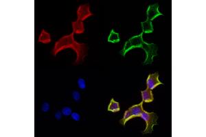 ABIN6262995 and ABIN6272963 staining Hela cells by IF/ICC.