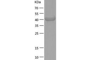 Western Blotting (WB) image for Phosphate Cytidylyltransferase 2, Ethanolamine (PCYT2) (AA 1-389) protein (His tag) (ABIN7124397) (PCYT2 Protein (AA 1-389) (His tag))