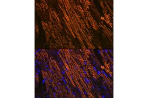 Immunofluorescence analysis of mouse heart using Cardiac Cardiac troponin T (TNNT2) (TNNT2) Rabbit mAb (ABIN7266088) at dilution of 1:100 (40x lens). (Cardiac Troponin T2 抗体)