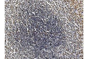 IHC analysis of RRS1 using anti-RRS1 antibody (ABIN7601344). (RRS1 抗体  (AA 33-266))