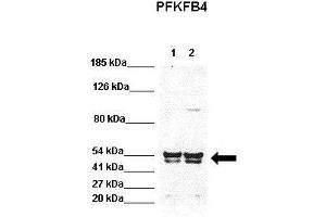 WB Suggested Anti-PFKFB4 Antibody  Positive Control: Lane 1:441 µg HEK293 lysate Lane 2: 041 µg H1299 lysate Primary Antibody Dilution: 1:0000Secondary Antibody: Goat anti-rabbit-HRP Secondry  Antibody Dilution: 1:0000Submitted by: Jose Luis Rosa, Universitat de Barcelona (PFKFB4 抗体  (N-Term))