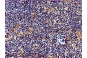 Image no. 7 for anti-NADH Dehydrogenase (Ubiquinone) Complex I, Assembly Factor 7 (NDUFAF7) antibody (ABIN1499667) (NDUFAF7 抗体)