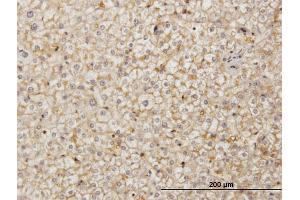 Immunoperoxidase of monoclonal antibody to SDF2 on formalin-fixed paraffin-embedded human liver. (SDF2 抗体  (AA 20-211))