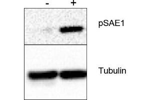 Image no. 1 for anti-SUMO1 Activating Enzyme Subunit 1 (SAE1) (Ser185) antibody (ABIN401468) (SAE1 抗体  (Ser185))