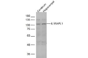 Lane 1: mouse cerebrum Lane 2: mouse hippocampal lysates probed with IL1RAPL1 Polyclonal Antibody, Unconjugated  at 1:1000 dilution and 4˚C overnight incubation. (IL1RAPL1 抗体  (AA 301-400))