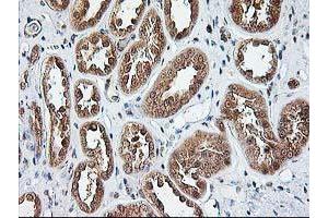 Immunohistochemical staining of paraffin-embedded Human Kidney tissue using anti-NUDT9 mouse monoclonal antibody. (NUDT9 抗体)