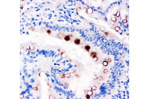 Anti-Estrogen Inducible Protein pS2 antibody, IHC(P) IHC(P): Rat Intestine Tissue (TFF1 抗体  (Middle Region))