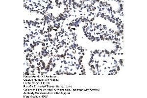 Human Lung (LHX3 抗体  (Middle Region))