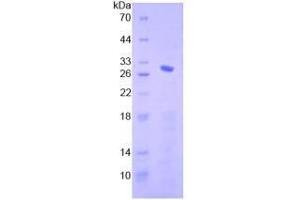 SDS-PAGE analysis of Human Smad4 Protein. (SMAD4 蛋白)