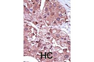 Immunohistochemistry (Paraffin-embedded Sections) (IHC (p)) image for anti-Activin A Receptor Type II-Like 1 (ACVRL1) (AA 474-503), (C-Term) antibody (ABIN392242)