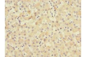 Immunohistochemistry of paraffin-embedded human liver tissue using ABIN7159906 at dilution of 1:100 (TIMM5 (AA 87-353) 抗体)
