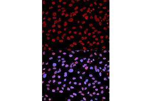 Immunofluorescence analysis of U2OS cells using IFIH1 antibody (ABIN5971229). (IFIH1 抗体)
