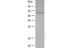 Secretogranin III (SCG3) (AA 20-468) protein (His-IF2DI Tag)