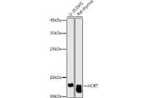Western blot analysis of extracts of various cell lines, using HCRT antibody (ABIN6128406, ABIN6141654, ABIN6141655 and ABIN6225128) at 1:500 dilution. (Orexin 抗体  (AA 34-131))