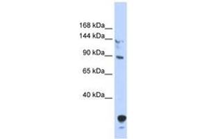 Image no. 1 for anti-Tubby Like Protein 4 (TULP4) (N-Term) antibody (ABIN6742856) (TULP4 抗体  (N-Term))