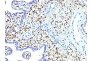 IHC testing of FFPE human placenta with FSP1 antibody (clone S100A4/1481). (s100a4 抗体)