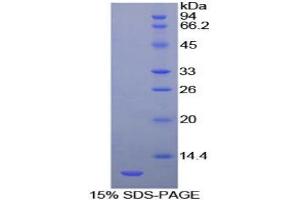 SDS-PAGE analysis of Cow HSPA8 Protein. (Hsc70 蛋白)