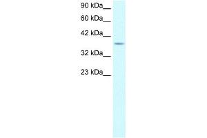 WB Suggested Anti-KLF8 Antibody Titration:  0. (KLF8 抗体  (Middle Region))
