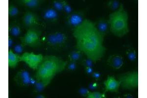 Anti-ACAT2 mouse monoclonal antibody (ABIN2452684) immunofluorescent staining of COS7 cells transiently transfected by pCMV6-ENTRY ACAT2 (RC201821). (ACAT2 抗体)