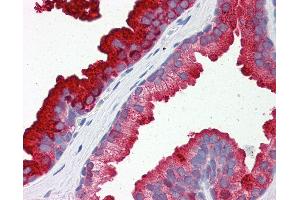 Anti-RAB23 antibody IHC of human prostate. (RAB23 抗体  (AA 35-84))