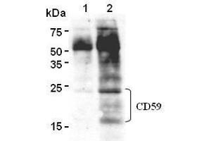 Western Blotting (WB) image for anti-CD59 (CD59) antibody (ABIN1449269) (CD59 抗体)
