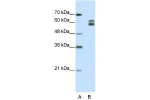 WB Suggested Anti-MSH2 Antibody Titration:  1. (MSH2 抗体  (N-Term))