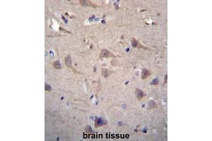 Immunohistochemistry (Paraffin-embedded Sections) (IHC (p)) image for anti-Chaperonin Containing TCP1, Subunit 8 (Theta) (CCT8) (AA 518-548), (C-Term) antibody (ABIN951141)