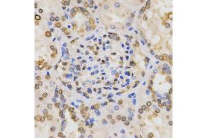 Immunohistochemistry of paraffin-embedded human kidney tissue using H3K36me2 antibody at dilution of 1:200 (x400 lens) (Histone 3 抗体  (H3K36me2))