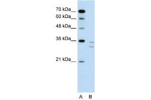 CD8B antibody used at 1 ug/ml to detect target protein. (CD8B 抗体  (N-Term))