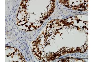 Image no. 1 for anti-Deleted in Azoospermia 1 (DAZ1) (AA 21-121) antibody (ABIN598639) (DAZ1 抗体  (AA 21-121))