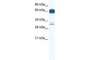 WB Suggested Anti-ZIC5 Antibody Titration:  0. (ZIC5 抗体  (N-Term))