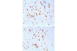 Immunohistochemical analysis of paraffin-embedded human brain tissues, showing cytoplasmic localization with DAB staining using FMR1 monoclonal antibody, clone 4G9  .