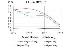 Red: Control Antigen (100 ng), Purple: Antigen (10 ng), Green: Antigen (50 ng), Blue: Antigen (100 ng), (CCAR2 抗体)