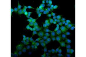 IF analysis of eRF1/ETF1 using anti-eRF1/ETF1 antibody (ABIN7602625).