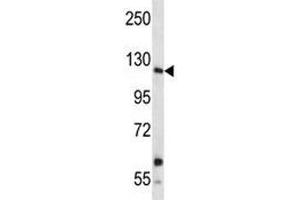 Insulin receptor R antibody western blot analysis in A549 lysate. (INSRR 抗体  (AA 1228-1255))