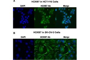 Immunofluorescent staining of (A) HCT-116 and (B) SK-OV-3 cells with HOXB7 polyclonal antibody  under 4 ug/mL working concentration. (HOXB7 抗体  (AA 168-217))