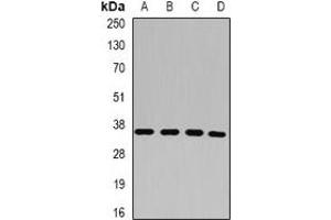 Western blot analysis of p43 expression in HepG2 (A), HT29 (B), MCF7 (C), A549 (D) whole cell lysates. (p43 抗体)