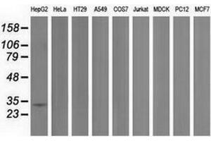 Western blot analysis of extracts (35 µg) from 9 different cell lines by using anti-PECR monoclonal antibody. (PECR 抗体)