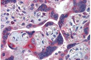 Human Placenta (formalin-fixed, paraffin-embedded) stained with GTPBP10 antibody ABIN462237 followed by biotinylated goat anti-rabbit IgG secondary antibody ABIN481713, alkaline phosphatase-streptavidin and chromogen. (GTPBP10 抗体  (AA 254-303))