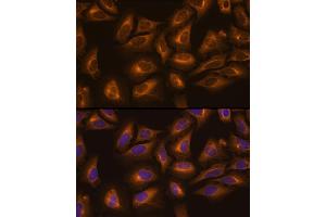 Immunofluorescence analysis of U-2 OS cells using LysRS/LysRS/KARS Rabbit pAb (ABIN6128149, ABIN6142683, ABIN6142684 and ABIN6217884) at dilution of 1:100 (40x lens). (KARS 抗体  (AA 298-597))