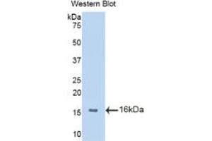 Western Blotting (WB) image for Macrophage Migration Inhibitory Factor (Glycosylation-Inhibiting Factor) (MIF) ELISA Kit (ABIN6574190)