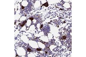 Immunohistochemical staining of human bone marrow with PSMD11 polyclonal antibody  shows strong cytoplasmic positivity in megakaryocytes.
