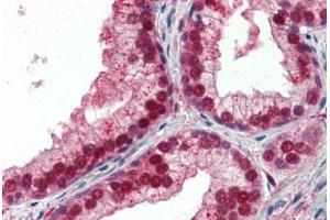 Human Prostate (formalin-fixed, paraffin-embedded) stained with NFIX antibody ABIN462183 followed by biotinylated goat anti-rabbit IgG secondary antibody ABIN481713, alkaline phosphatase-streptavidin and chromogen. (NFIX 抗体  (AA 181-230))