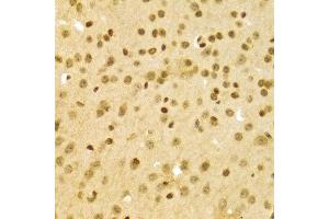 Immunohistochemistry (IHC) image for anti-Dyskeratosis Congenita 1, Dyskerin (DKC1) (AA 245-514) antibody (ABIN1512829)