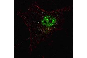 Immunofluorescence (IF) image for anti-Pancreatic and Duodenal Homeobox 1 (PDX1) (AA 1-30) antibody (ABIN388774)