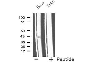 Western blot analysis of extracts from HeLa cells, using IL11RA antibody. (IL11RA 抗体  (C-Term))