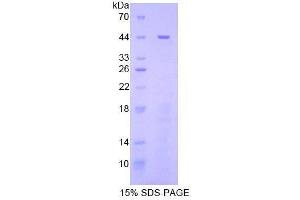 SDS-PAGE (SDS) image for Signal Transducer and Activator of Transcription 3 (Acute-Phase Response Factor) (STAT3) (AA 656-768) protein (His tag) (ABIN1879281)